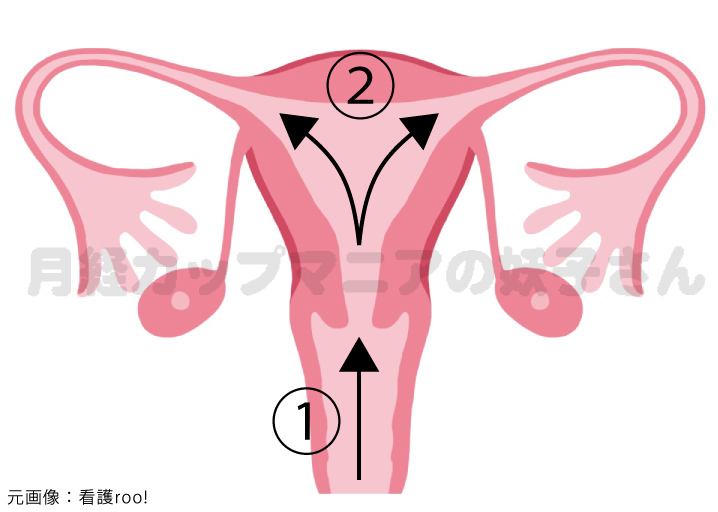 経血の逆流_月経カップ情報サイトCupsWithYou